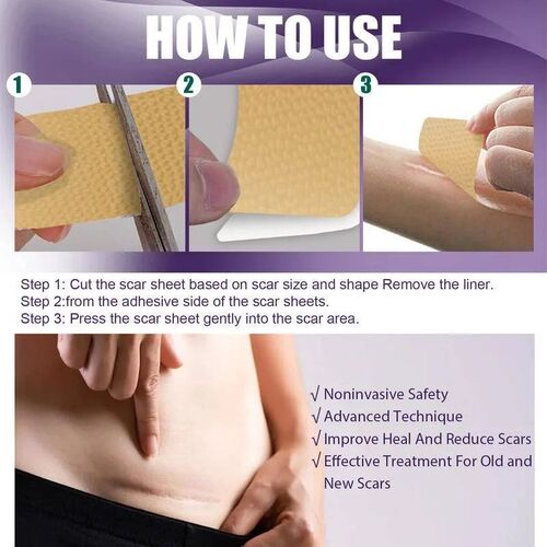 8pcs Silicone Scar Sheets Painless Repair Tape Scar Removal