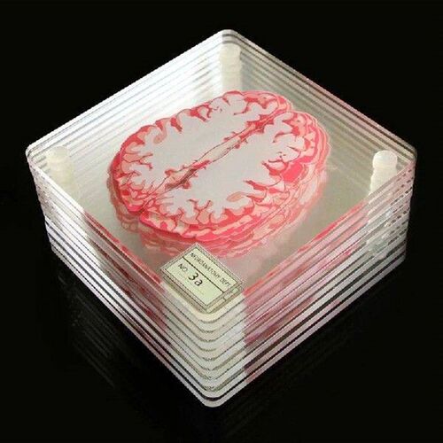 Brain Specimen Coasters Set 3D Organ Brain Artwork Brain