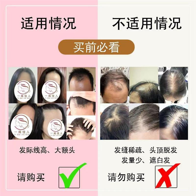 前额无痕发际线假发贴真发隐形女士自然刘海假发补发前额美人尖贴