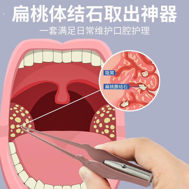 喉咙异物取出器扁桃体结石去除工具手动冲牙清理清洁冲洗隐窝神器