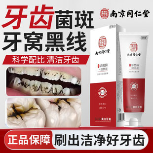 儿童牙齿黑线去除黑渍黑斑牙窝沟牙膏牙菌斑祛除黑色素沉淀神器YZ