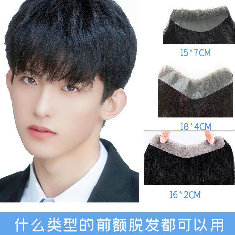 假发片男前额M发际线贴片补发片头顶假发贴生物头皮全真人发背头