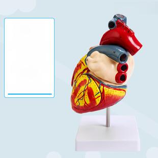 教学人工1:1人体心脏模型b超超声医学心脏病学天然大心脏解剖模型