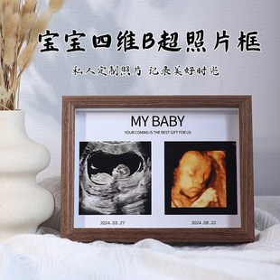 宝宝四维照片定制相框孕期nt b超彩超图打印婴儿记录摆台纪念相册