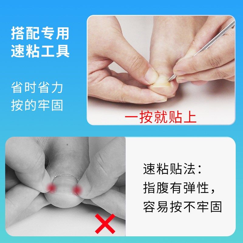 正甲贴嵌甲甲沟脚趾甲脚沟甲片贴片指甲盖内嵌卷甲炎非矫正器专用,家庭/个人清洁工具,美甲/修甲套装,淘宝优惠券,粉丝福利购,淘宝优惠卷