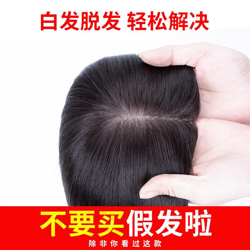 头顶补发片女遮盖白发真发假发片无痕补发块假刘海3d空气斜刘海片