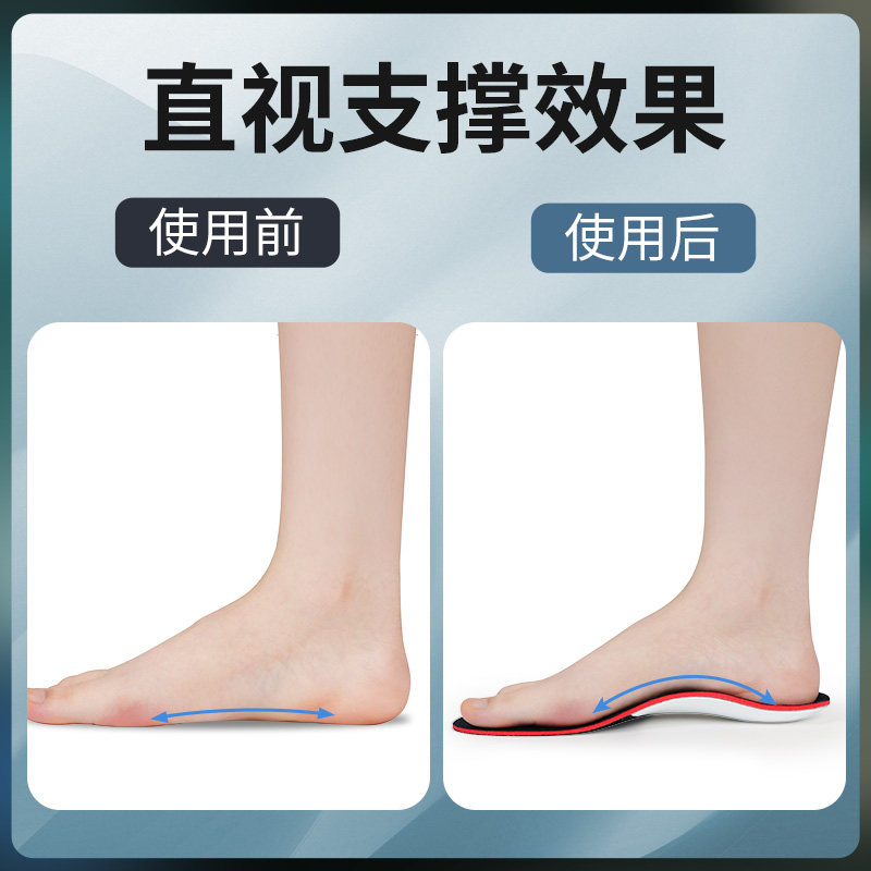 扁平足矫正鞋垫足弓支撑成人脚垫纠正足外翻重度平底足矫形器专用
