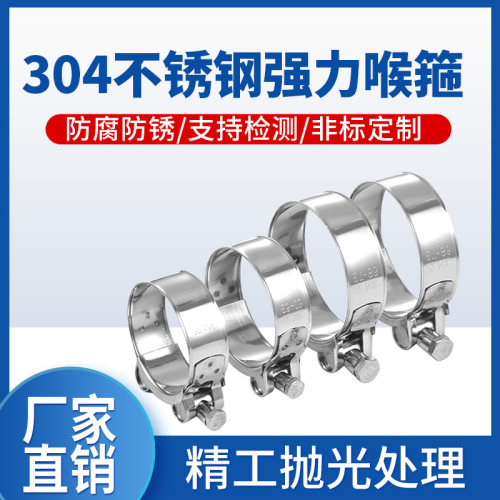 304不锈钢欧式强力喉箍 卡箍管夹管束抱箍圈水管管箍卡扣管卡固定