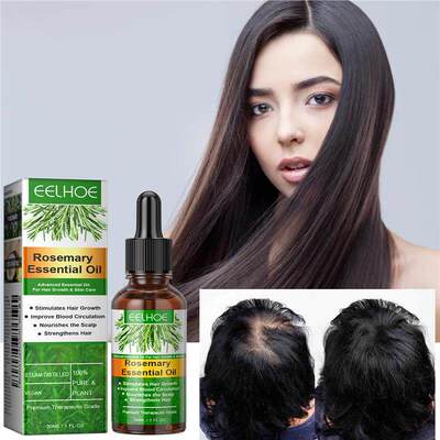 外贸 Hair Growth Rosemary Essential Oil 护发精油长效养护发丝