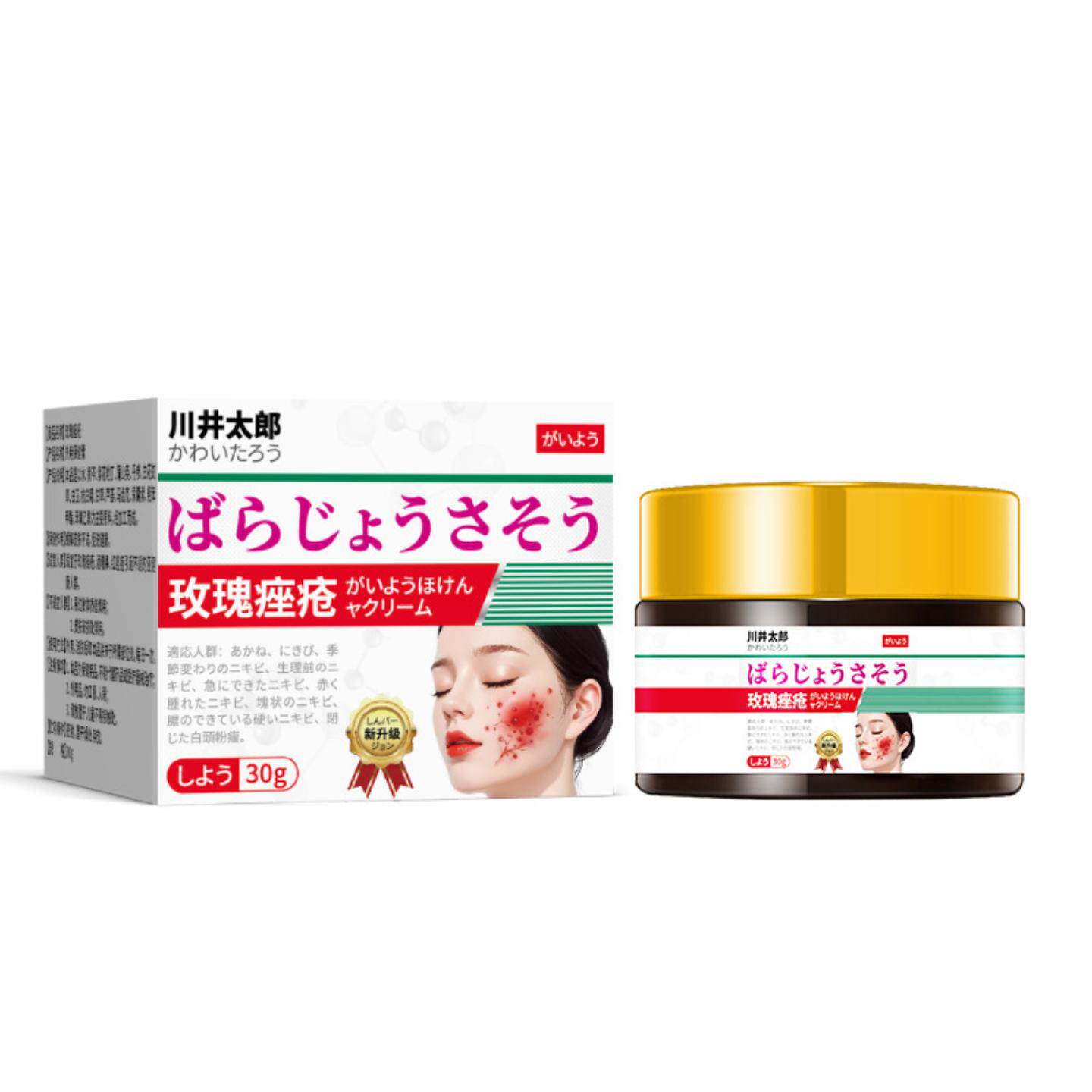 川井太郎脸上玫瑰痤疮膏屏障修复专用重度暗疮痘痘印坑软膏