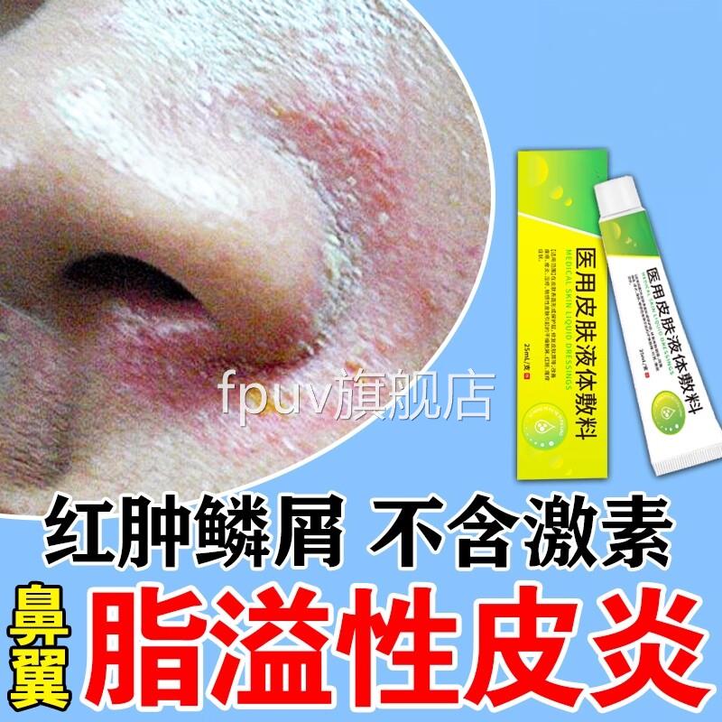 脂溢性皮炎面部药鼻翼眉间神经性皮炎鼻子发红脱皮干燥膏起皮FPUV