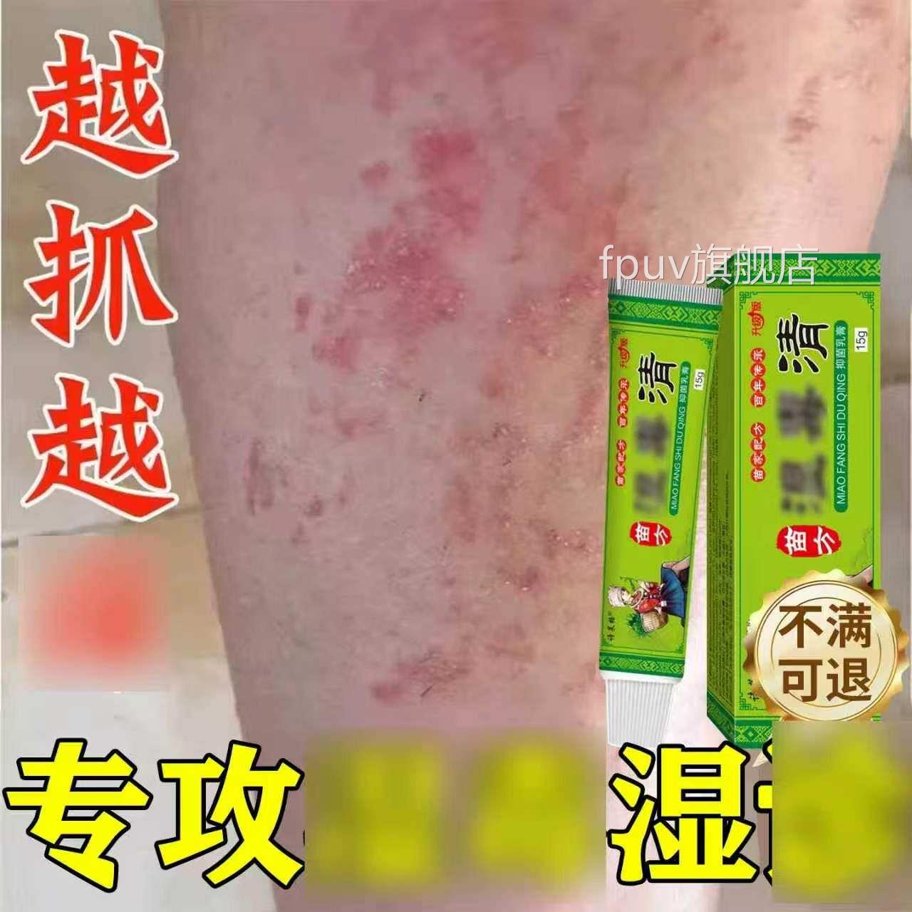 湿毒清抑菌软膏止痒皮肤痒专用药膏外用全身瘙旗舰店官方正品FPUV