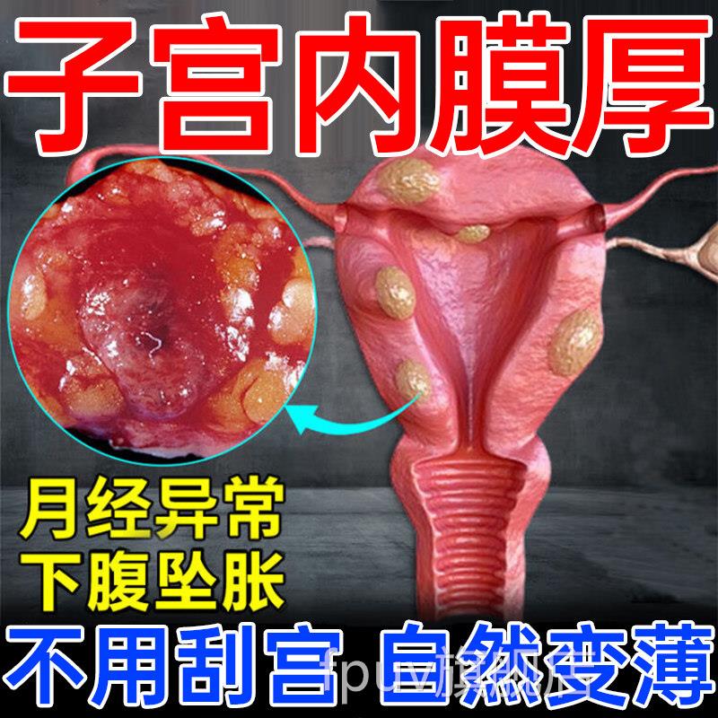 子宫内膜厚药调理增厚月经淋漓不尽的止血药异位症贴膏修复息肉LL