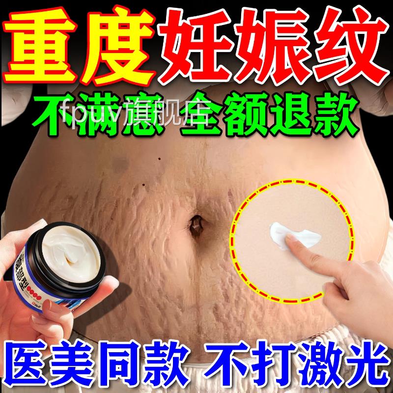 妊辰纹消除妊娠去纹非紧致肚皮非修复霜非淡化除疤痕膏遮盖神器FP