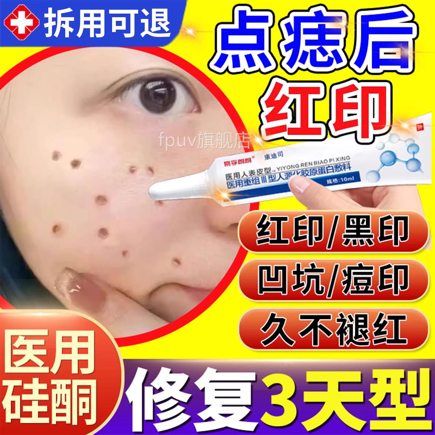 激光点液斑祛痣点痣后去红印修复膏退红淡印去痣凹陷疤痕专用T1旗