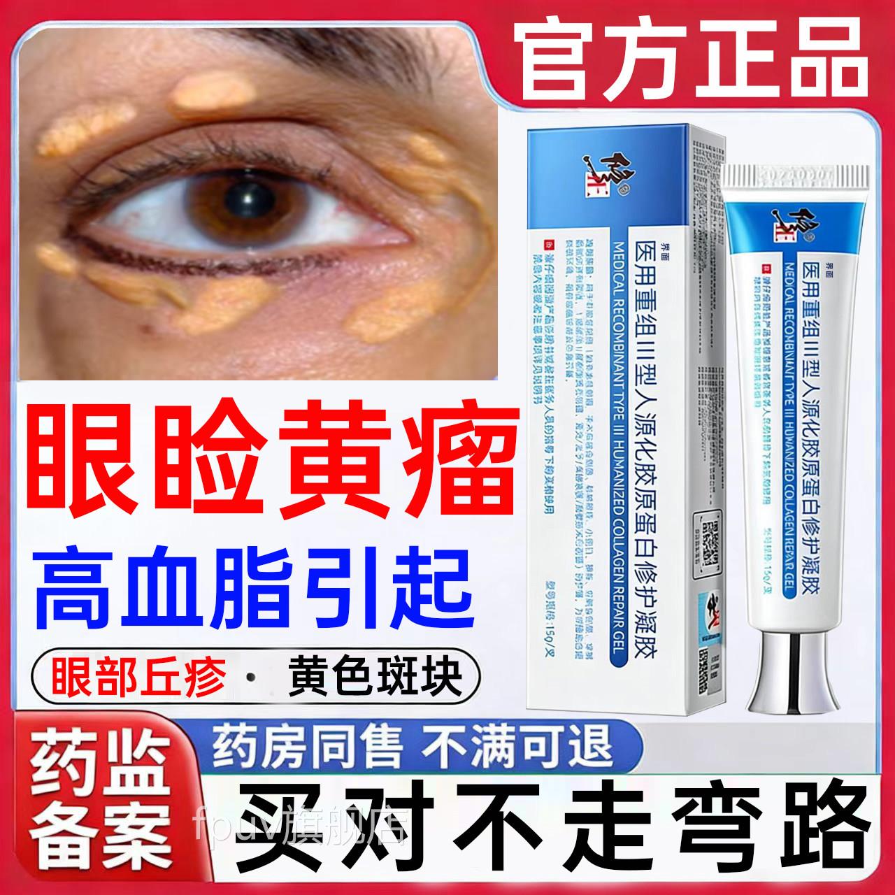 眼睑黄瘤去除眼皮黄W斑瘤专用膏睑黄疣去除神器眼角丘疹斑块凝胶Y