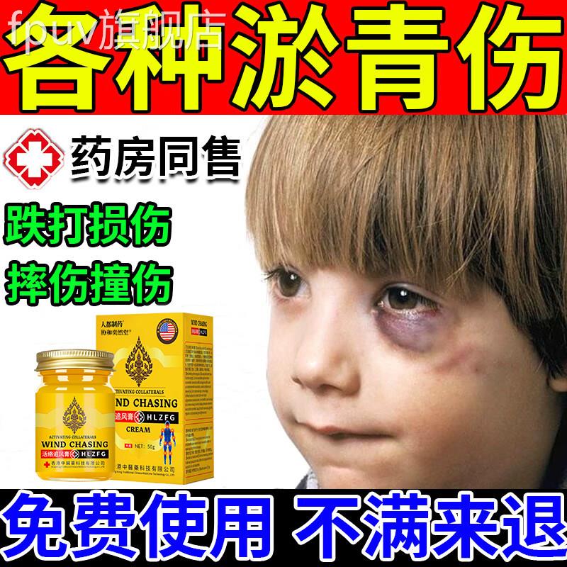 淤青膏快速消除宝淤青膏眼部眼睛活血化瘀宝去淤青摔倒膝盖腿磕碰
