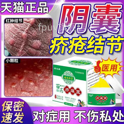 男士u阴囊疥疮结节疥疮膏疥螨疥虫杀虫剂喷雾私处潮湿瘙痒止痒9旗