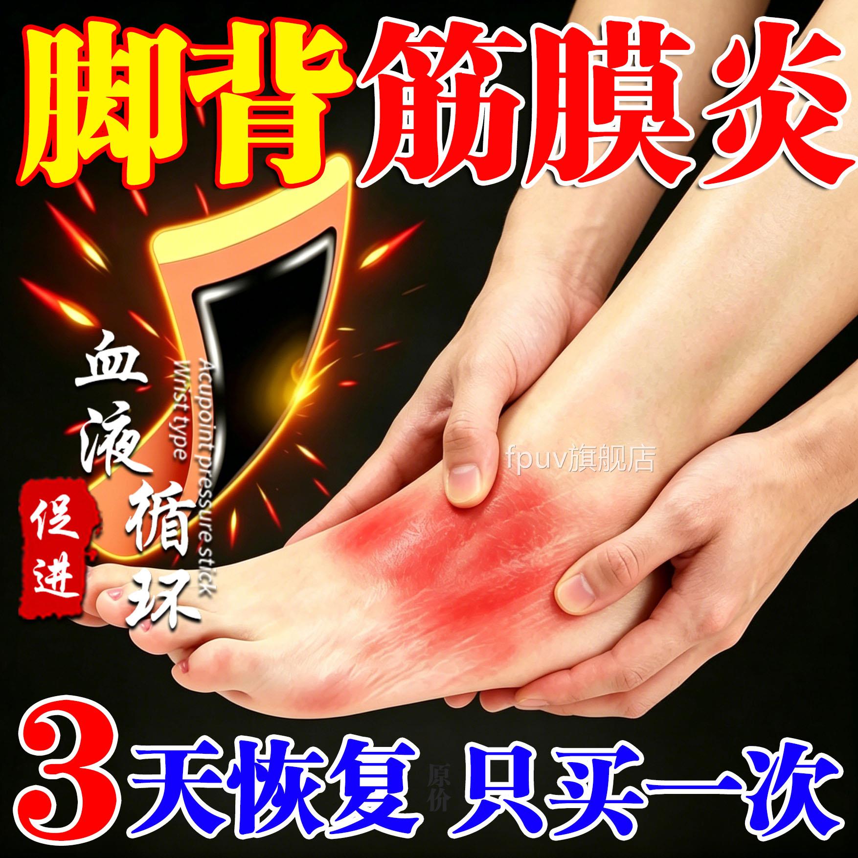 葵花脚背筋膜炎专用胀膏药贴脚踝扭伤脚面疼痛肿鼓包足底筋膜疼痛