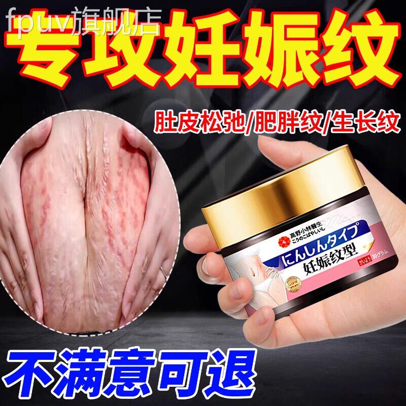 去肥胖纹修复消生霜长纹除大腿学生青少年专用去妊辰娠纹修复膏FP