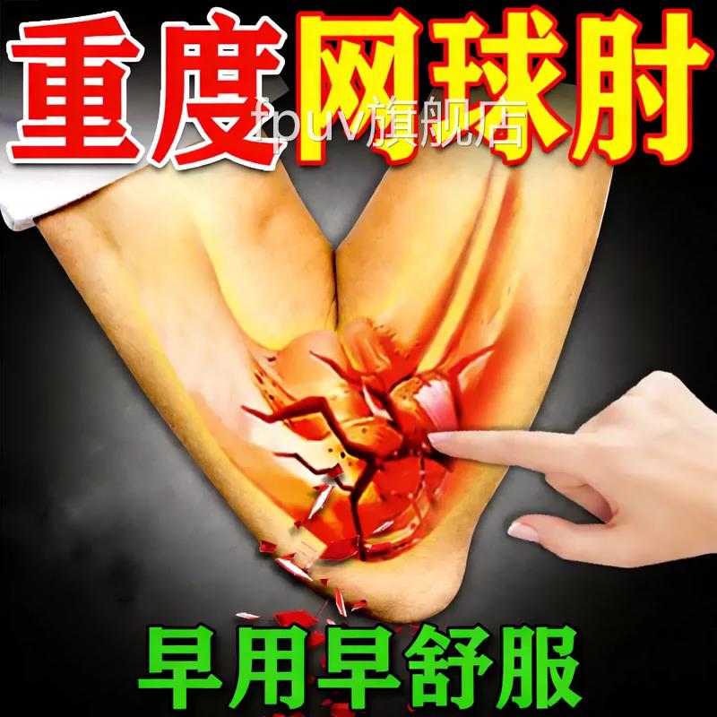 手臂筋膜疼手关节胳膊疼痛滑膜炎专用膏肌肉拉伤劳损修复搭药贴FP