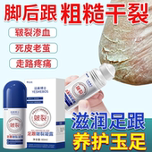 足膜脚后跟干裂脱皮嫩白保湿 美白去死皮脚皮脚部护理保养套装