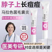 祛痘脖子上后背部长痘痘喷雾身体背上小疙瘩胸口马拉色菌毛囊炎QF