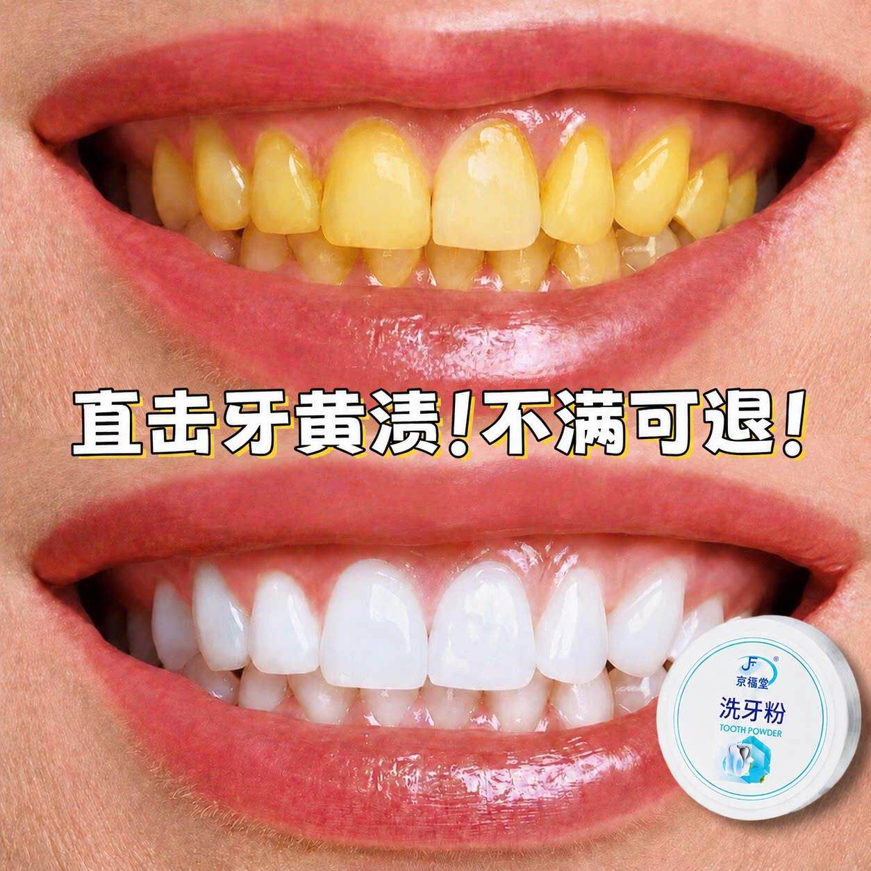 洁牙粉去黄洁牙渍牙垢洗去黄牙渍白牙除口臭烟渍清新口气亮白神器