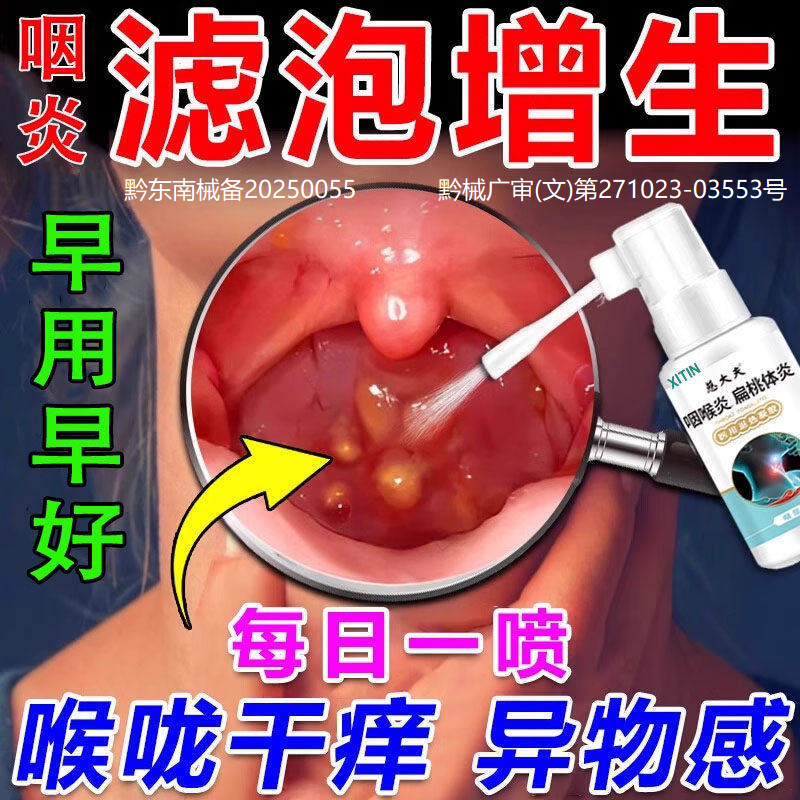 正品喉咙滤泡增生后壁淋巴慢性咽炎咽喉炎根专慢性咽炎除用喷剂LL