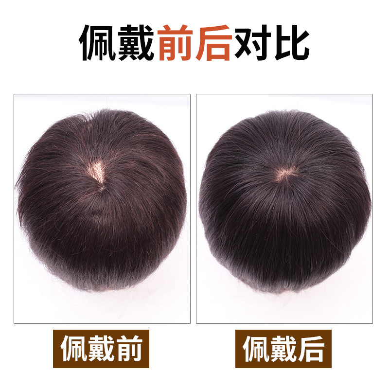 假发女头顶补发片一片式无痕补发递针顶心真发补发块补发顶遮白发
