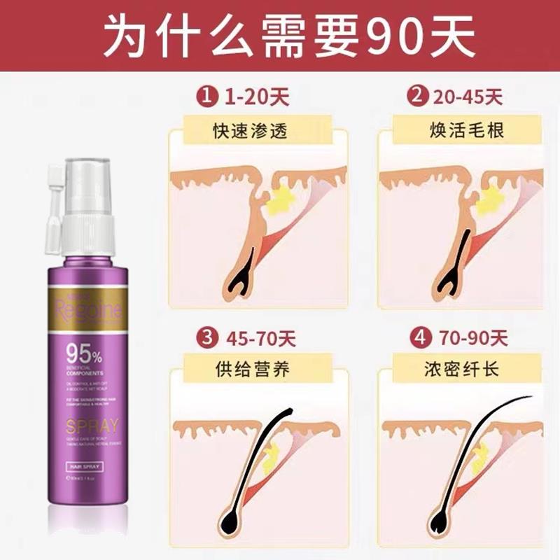 落健头发生长液脂溢性掉发断发女士专用发际线快速增长精华液神器