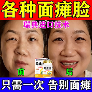 面瘫特热敷效神器否药膏贴脸部痉挛恢复神器神经后遗症面肌僵硬
