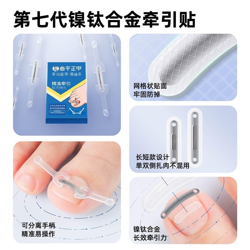 曲平甲沟嵌甲指甲矫正器正甲贴片脚趾甲盖卷甲内嵌神器固定足科炎