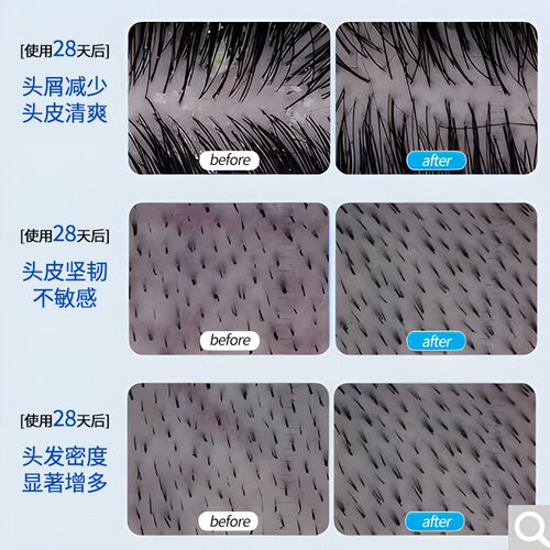 妮雀娜头皮鲜养梳红光梳头部按摩电动健发梳护理仪