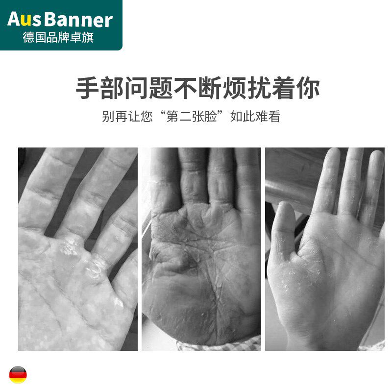 磨神器手指去死皮死皮手部工具茧子去除角质老茧搓去脚皮家用