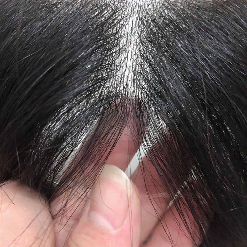 男士女生物头皮隐形无痕发际线超薄前额补发假发刘海贴片自然真发