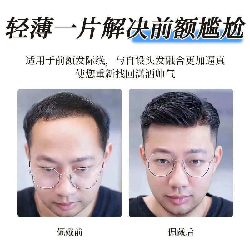 发际线假发贴男隐形无痕大背头造型前额假刘海生物头皮全真发M型