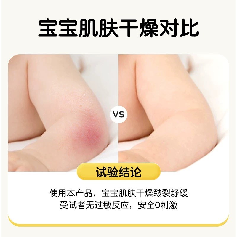 幼卡宝儿康霜口水膏新生婴儿护臀膏去痱湿痒儿童护肤宝宝霜专用