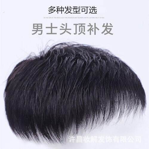 男士补发片假发男头顶补发前额秃顶补发垫接发翻盖假发真发男发块