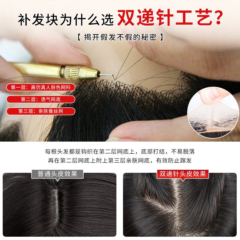 假发片真发头顶补发蓬松高颅顶增发量无痕轻薄双递针遮白发补发片