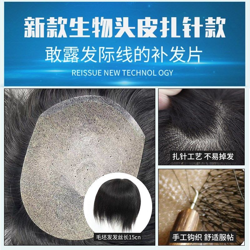 假发男士隐形无痕超薄生物头皮扎针短发手织真发头顶假发片补发块
