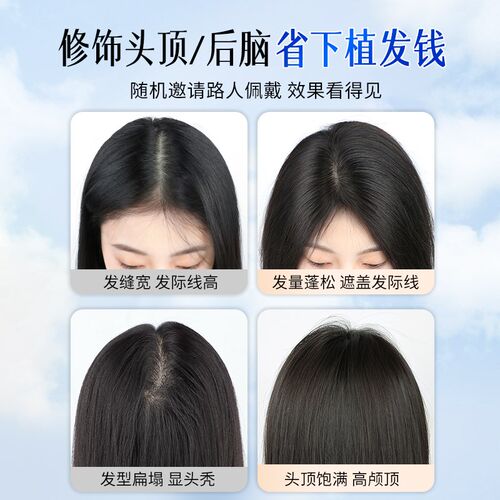 递针假发片女头顶遮白发蓬松增发量高颅顶轻薄款无痕全真发补发片