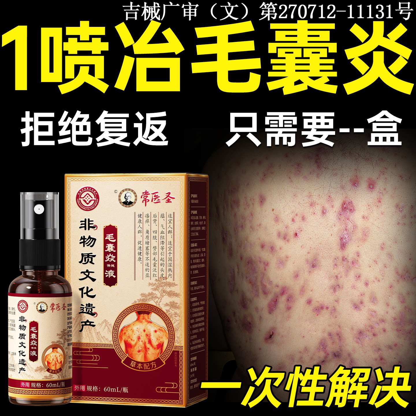 毛囊后背炎去除头皮痘痘除螨祛痘痒胳膊疙瘩手臂专用红疙瘩喷雾剂