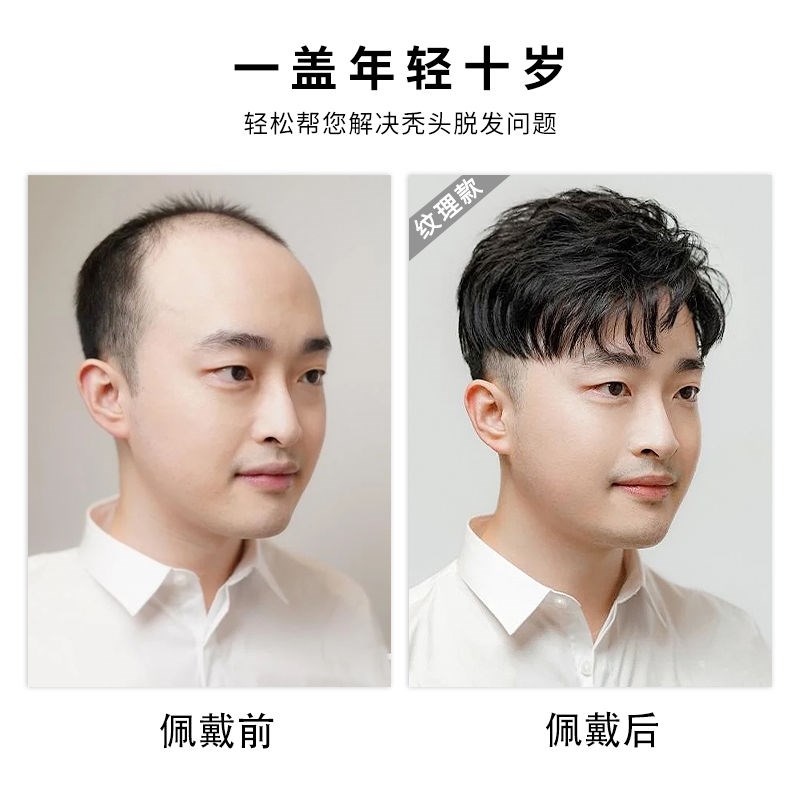 假发男短发毛寸真发无痕隐形假发片自然男士可卡轻薄头顶补发片