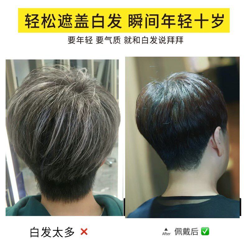 假发直发短发头顶补发片真发女士头顶补发缺发遮盖白发半头套发片