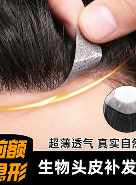 假发浏海男遮高额头假发片M型增发片前额发际线假发贴头顶补发片