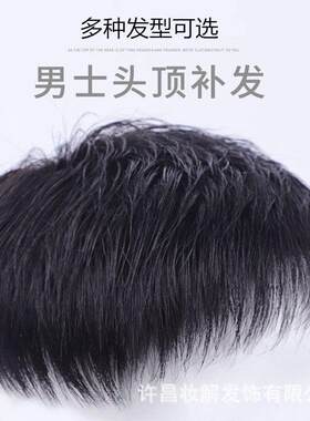 男士补发片假发男头顶补发前额秃顶补发垫接发翻盖假发真发男发块