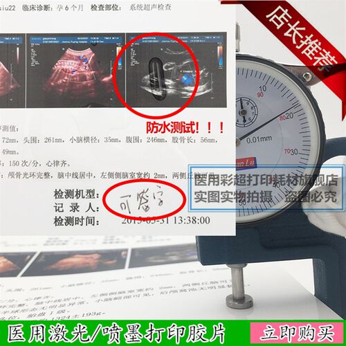 包邮医院用瓷 白A4喷墨胶片防水 胃肠镜病理 B超四维彩超声打印