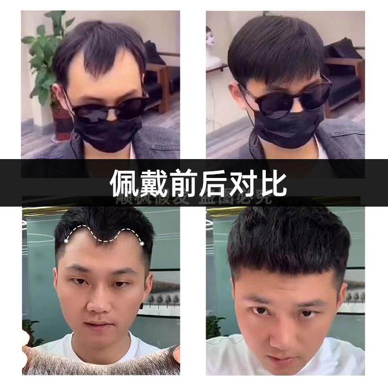 发际线鬓角假发贴男士前额补发隐形m型一片式真发贴刘海额角假发