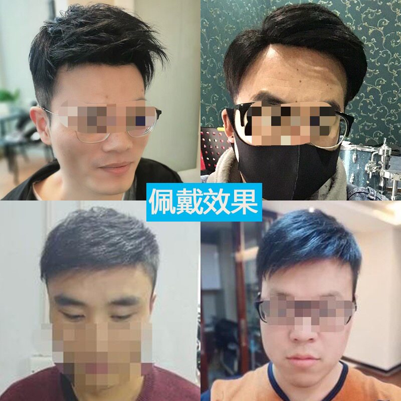 假发男补发男短发男士头顶中年补发真发手织补发片块头顶脱发补发